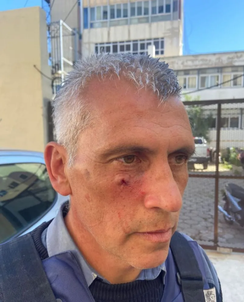 Policías heridos ayer en las afueras de la Legislatura en Viedma.